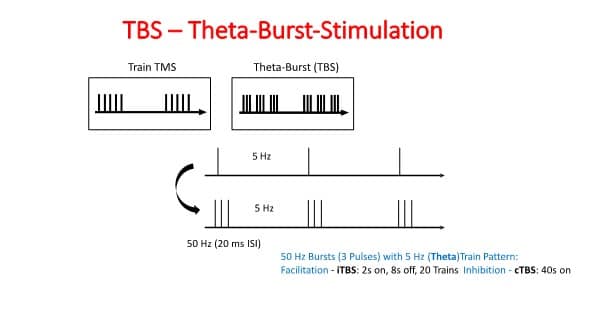 TMS Theta Burst Simulation